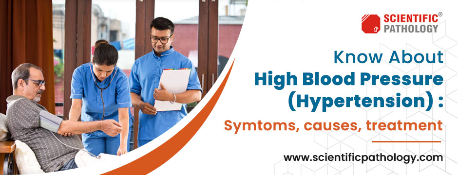 Know About High Blood Pressure (Hypertension) : Symptoms, Causes, Treatment